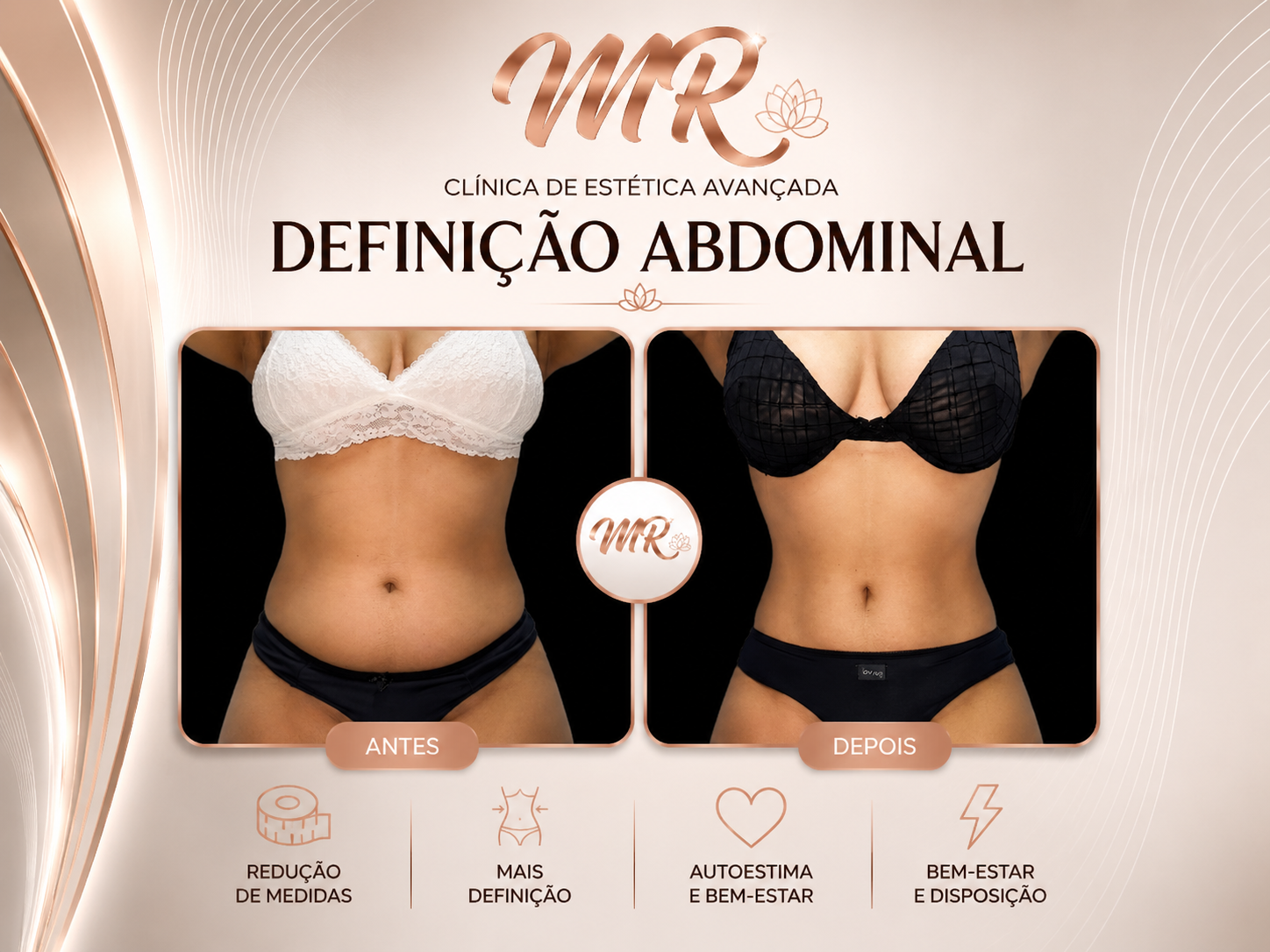Definição Abdominal
