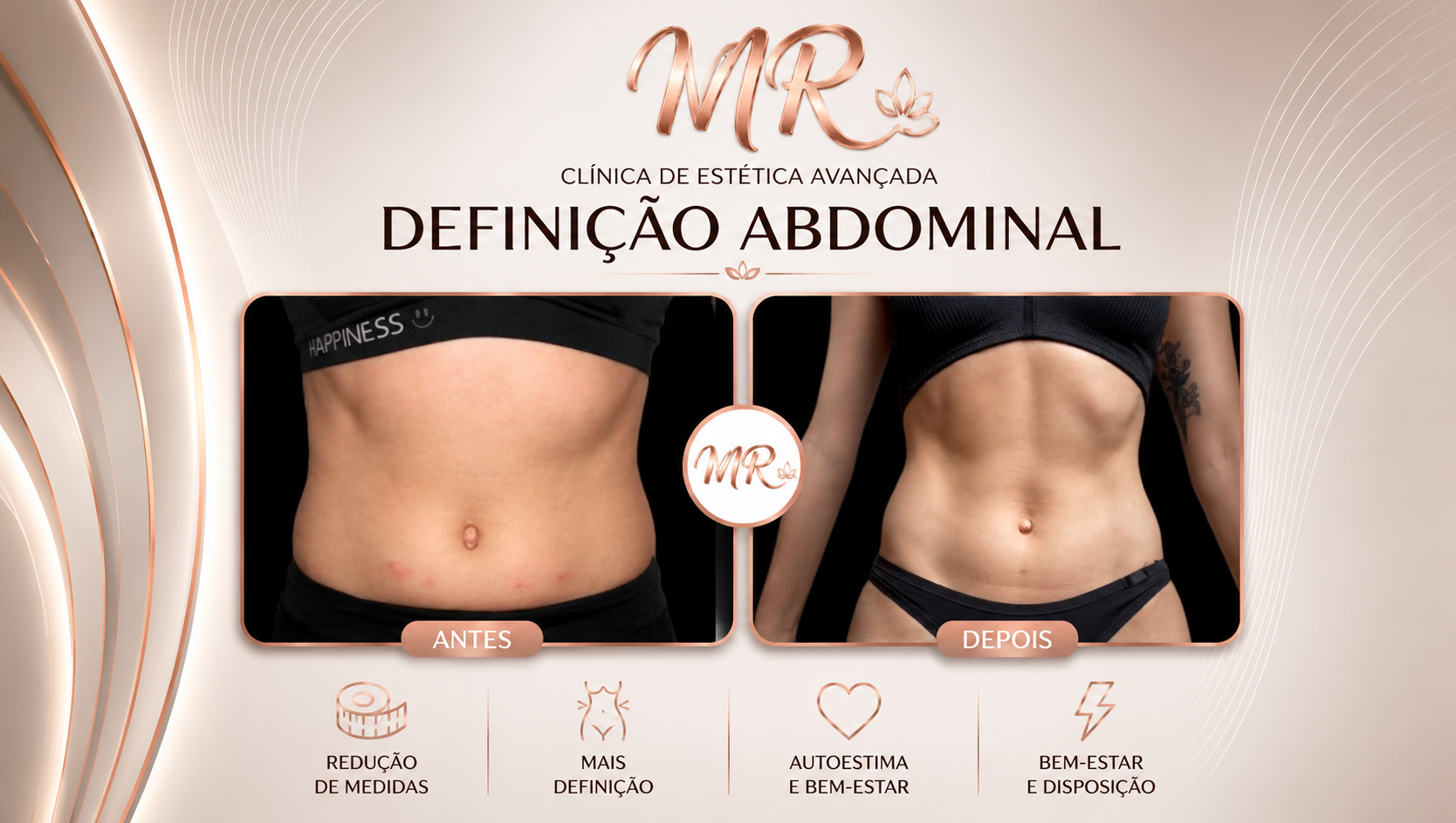 Definição Abdominal