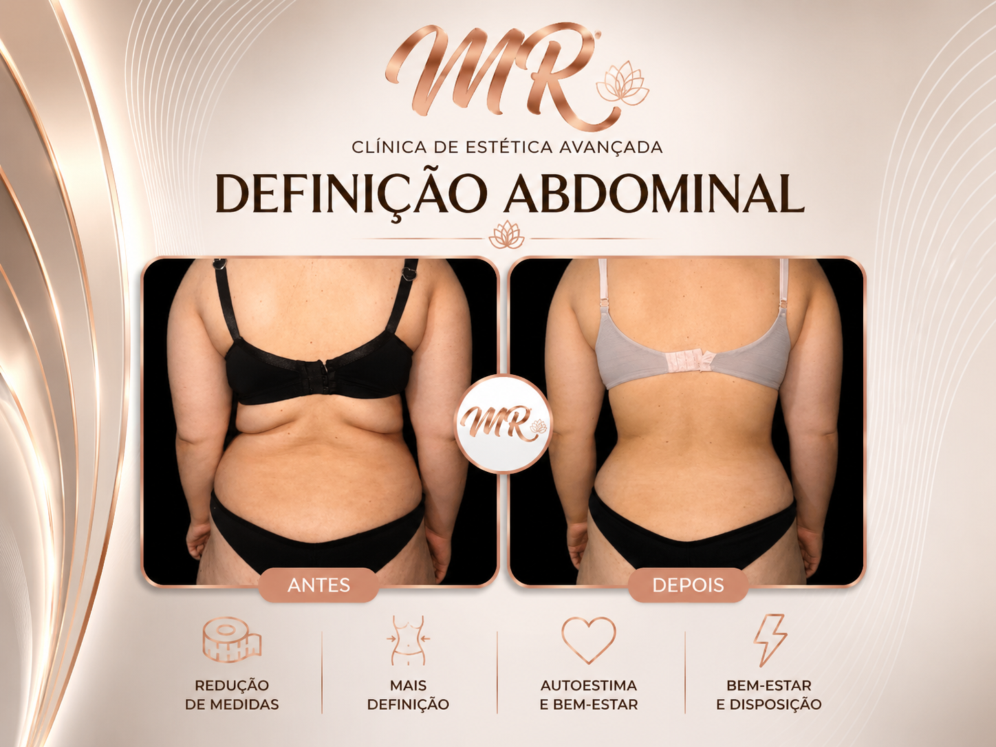 Modelagem Corporal